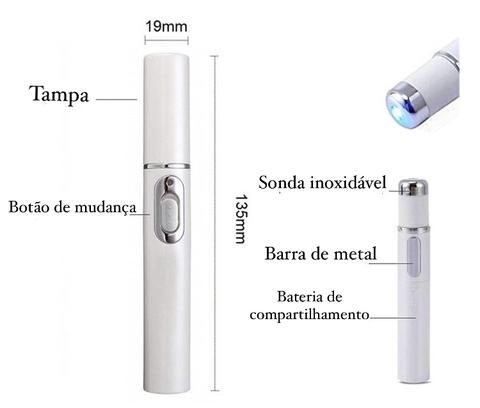 Blue Light Therapy Acne Scar Removal and Varicose Veins 